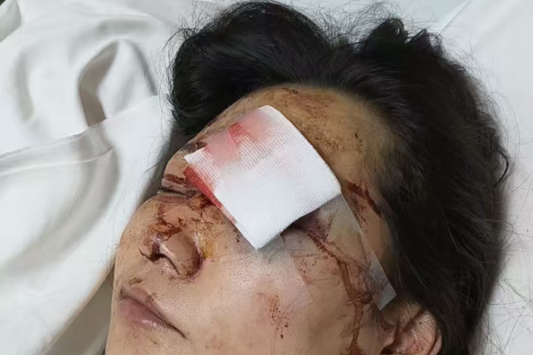 两男孩在禁燃区放烟花将路人炸伤失明，石碣有关部门回应
