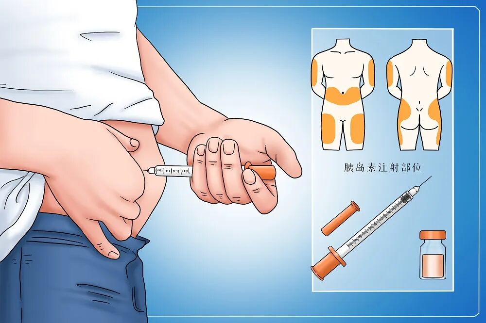 640?wx_fmt=jpeg&from=appmsg