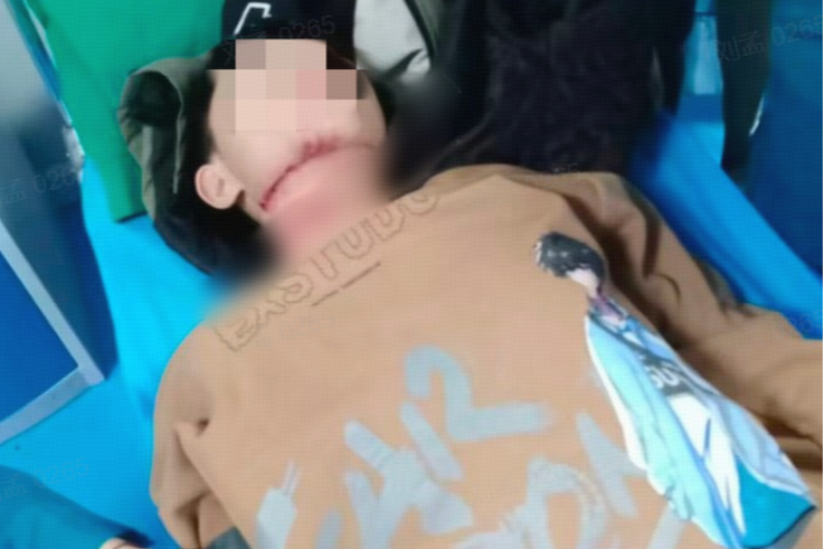 家属讲述沁阳男孩骑车遭绳索割喉细节：仍有一段气管未找到