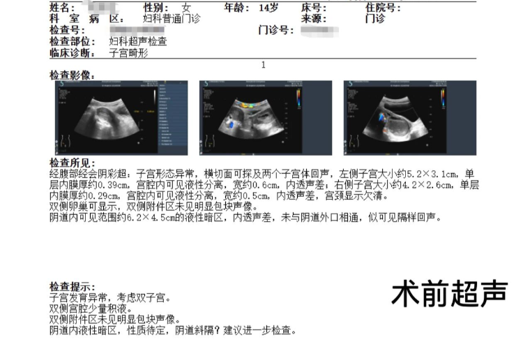 深圳14 岁少女月经初潮剧痛，一查竟有“双子宫双阴道”
