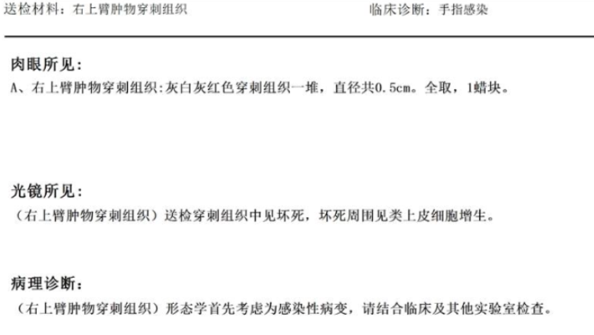 640?wx_fmt=png&from=appmsg